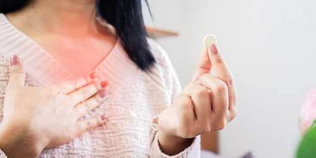 Acid Reflux Tablets: A Comprehensive Guide to Treating Acid Reflux