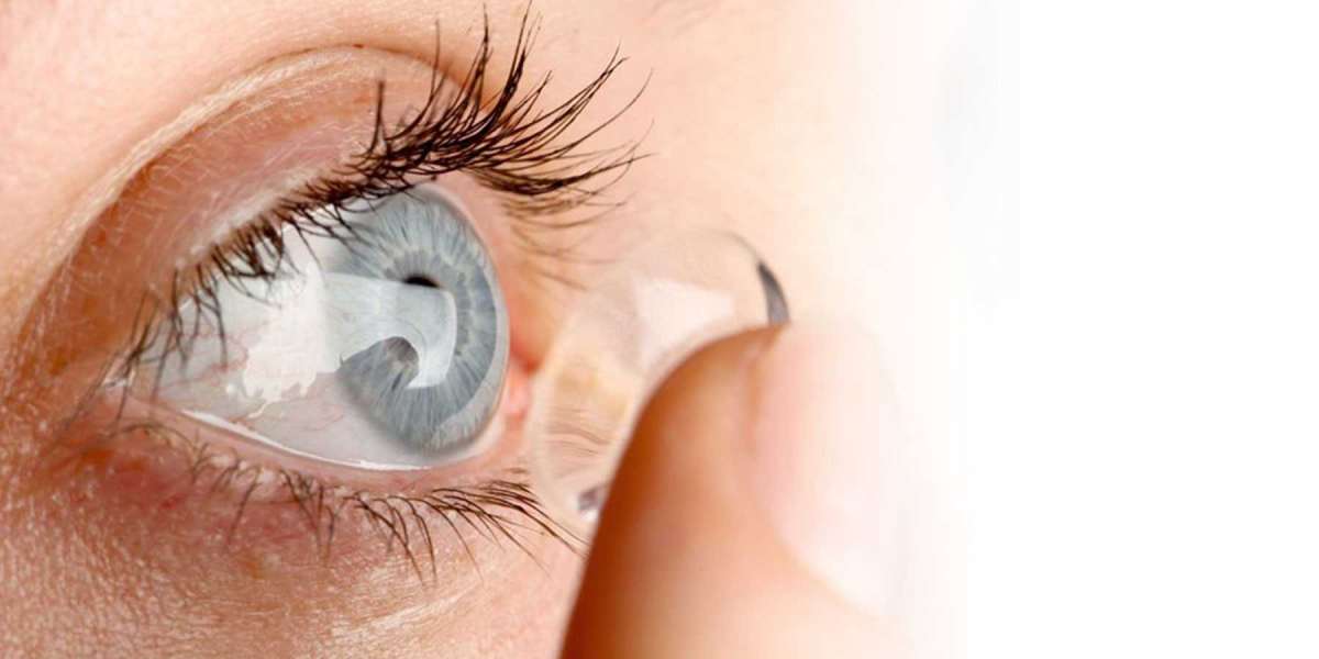 Contact Lenses Market Players Share Growth Ascent with an Expansion in the Quantity of Medical Services
