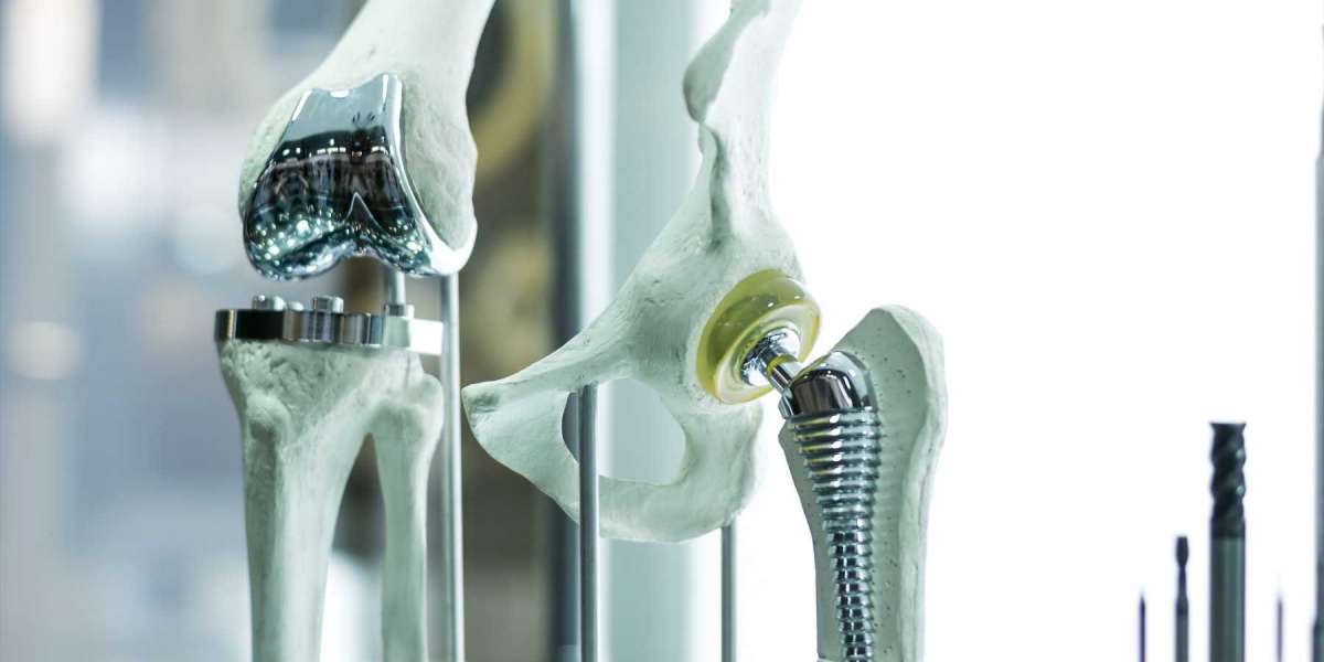 Americas Orthopedic Biomaterial Market Players Supportive Reimbursement Scenario