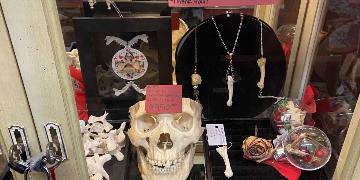 Mild Plagiocephaly Human Skull For Sale