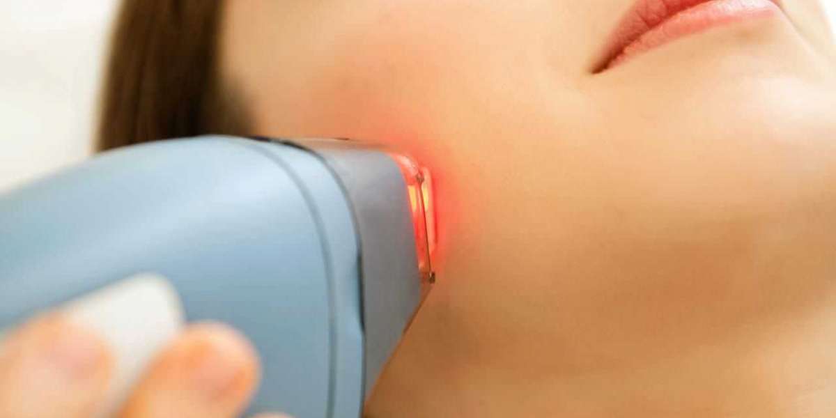 Revitalize Your Skin with Laser Treatment: Unlock Radiant Beauty