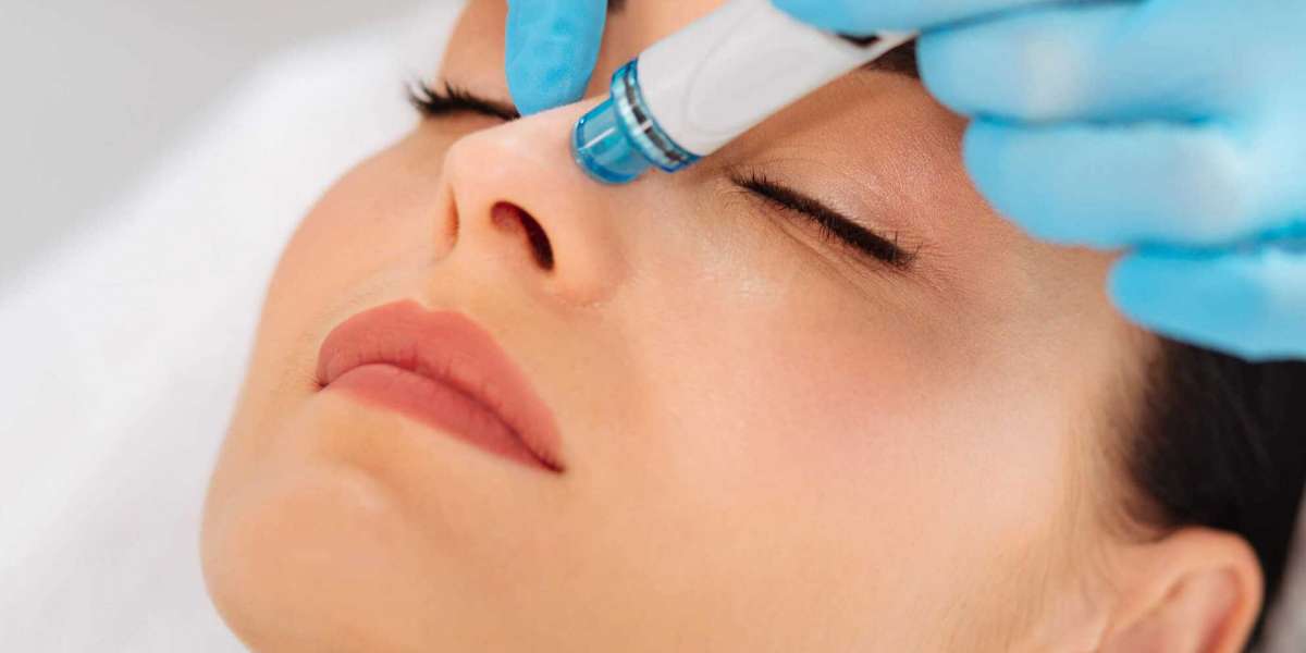 Discover the Ultimate HydraFacial Experience in Singapore