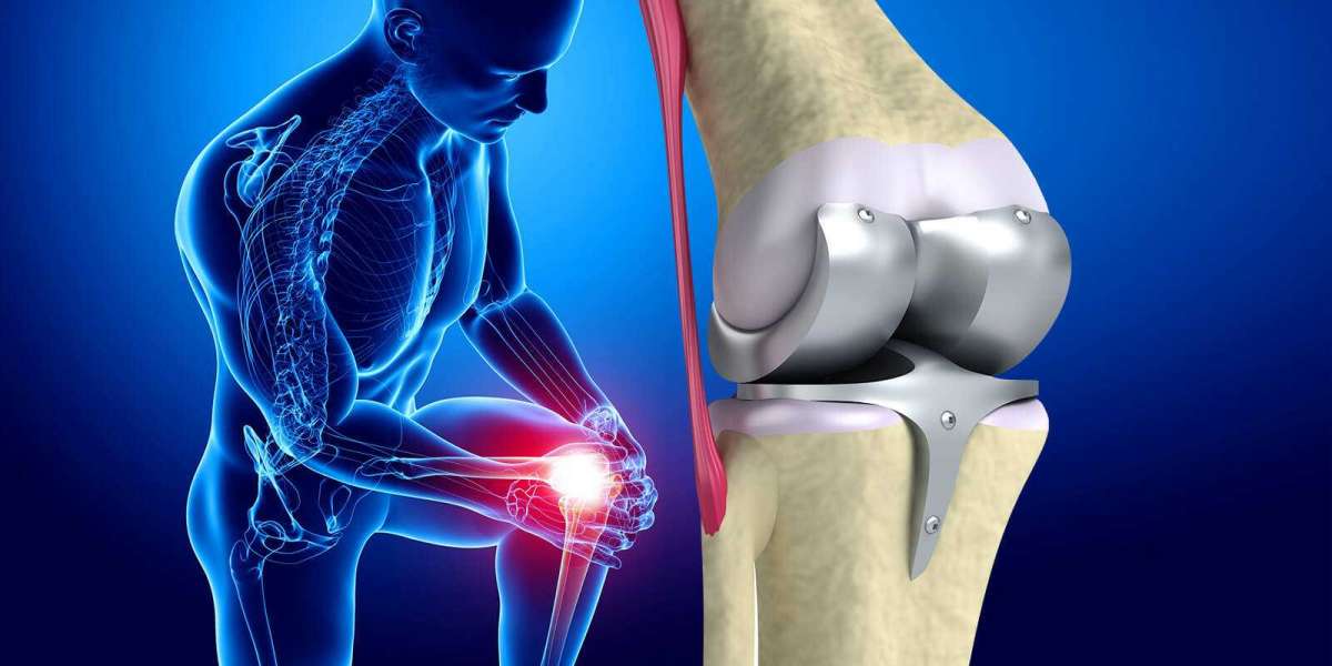 Growing Geriatric Population to Drive the Global Industry; Says Knee Replacement Market Insights