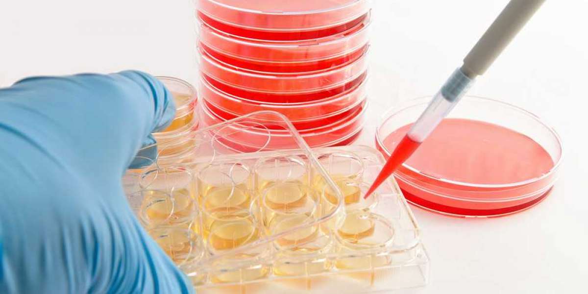 Global Automated Cell Culture Market Insights: Industry Grows Incredibly; Confirms MRFR