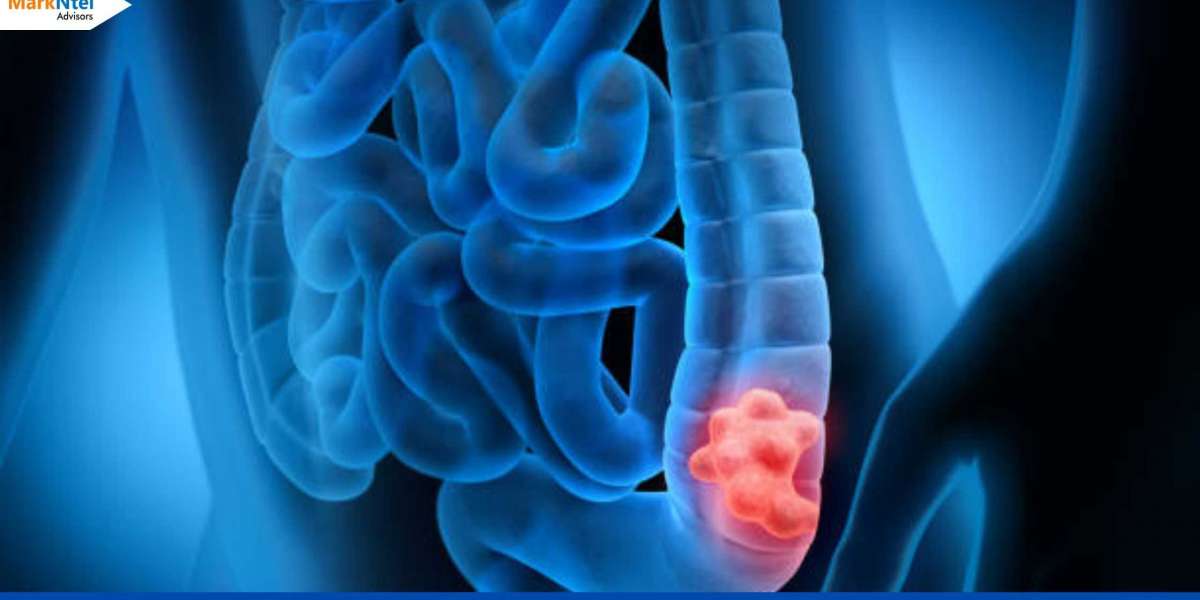 China Colorectal Cancer Treatment Market Analysis: Trends, Challenges, and Growth Opportunities in 2022-2027