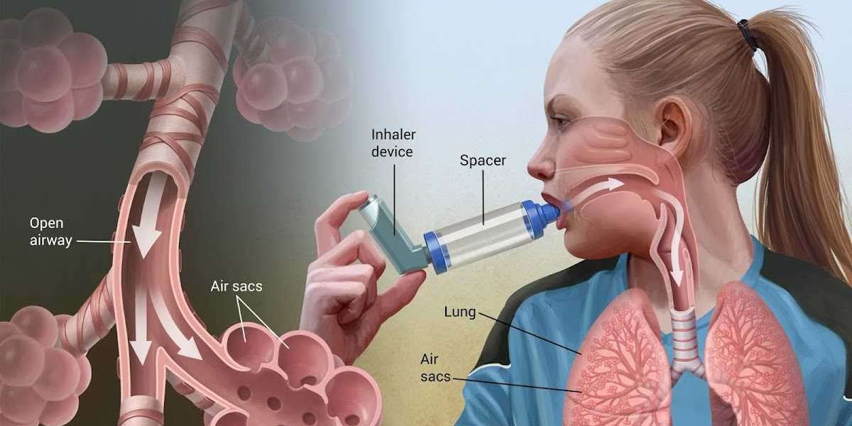 Asthma Inhaler Device Market Insights On Future Scope, Growth & Revenue of the Industry