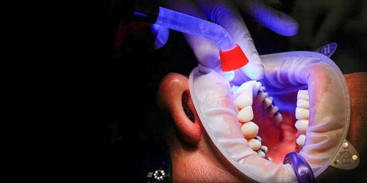 Discover the Pinnacle of Dental Care: Best Dentist in Bhopal at Smile Gallery Dental Wellness Centre