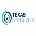 Texas Skin Vein