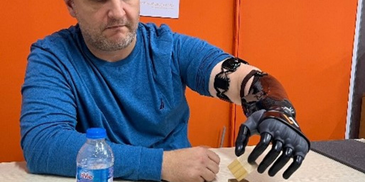 Living with a Prosthetic Arm: Tips for Daily Use and Maintenance
