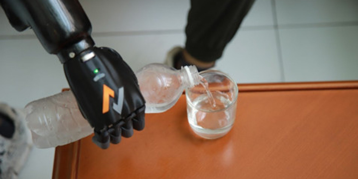 Enhancing Daily Activities: Functionalities of Bionic Hands and Arms