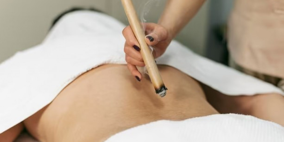 Holistic Harmony: Exploring Acupuncture for Weight Loss Wellness