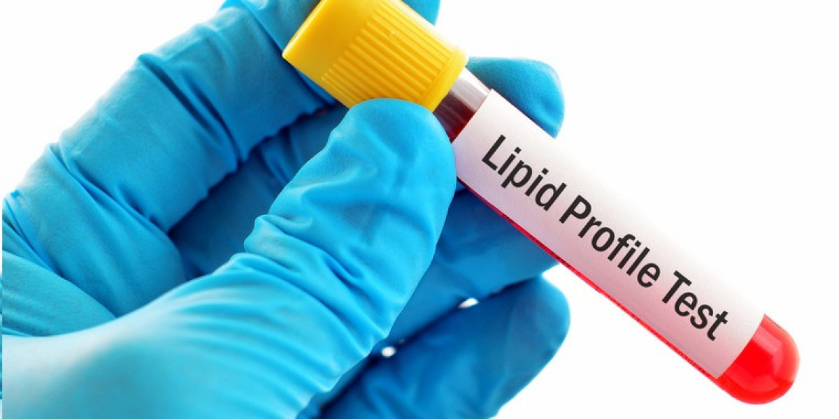 For Lipid Profile Tests Download - Agilus Diagnostics App