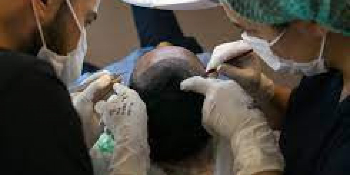 Hair Transplant in Dubai UAE ?