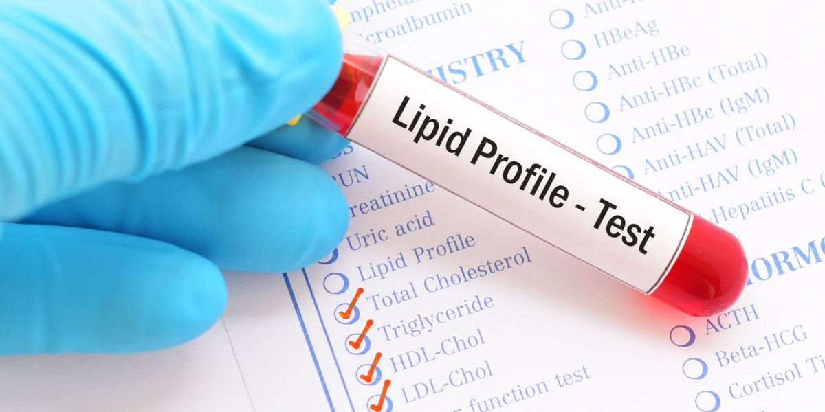 Book Lipid Profile Test Now - Agilus Diagnostic App