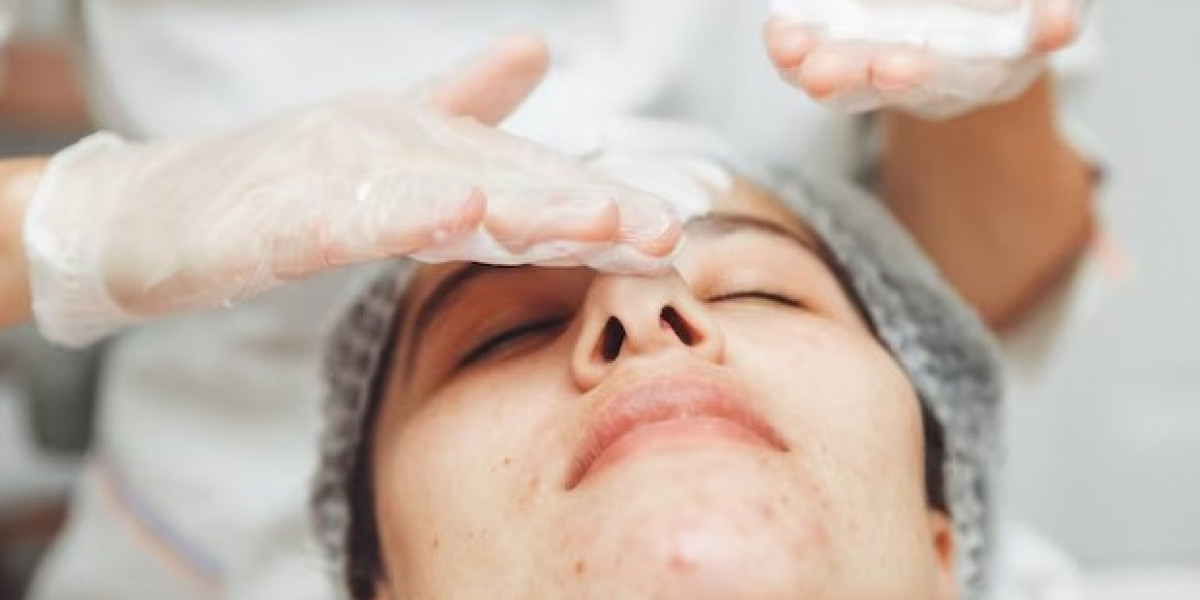 Rejuvenate Your Skin: Unlocking the Wonders of Laser Therapy for Acne Scars