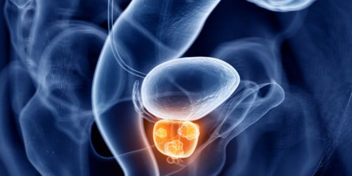 Castrate-Resistant Prostate Cancer Market By Therapy – Chemotherapy, Hormonal Therapy, Immunotherapy, Radiotherapy