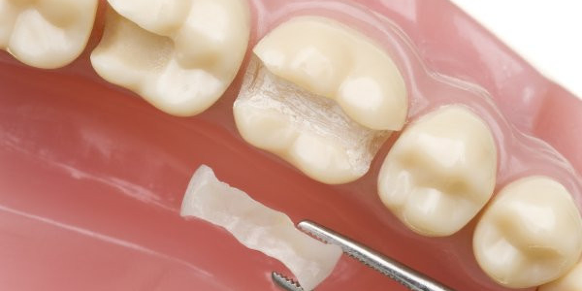Tooth Filling Materials Market Business Development, Size, Share, Trends, Industry Analysis, Forecast