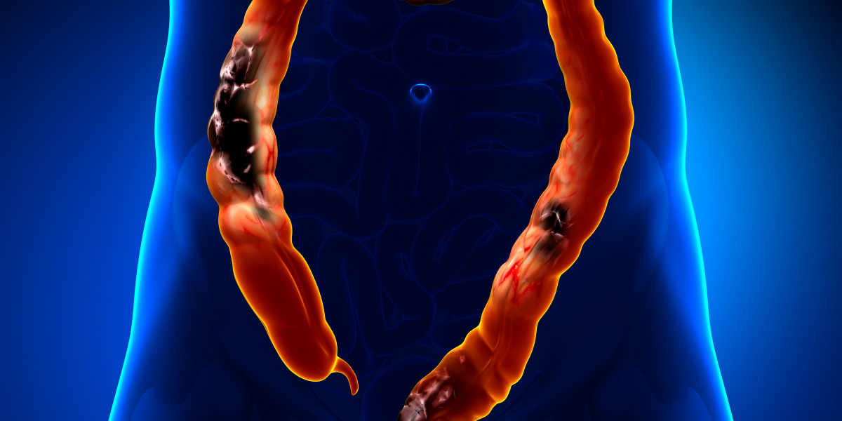 Colorectal Cancer Screening and Diagnostic Market Analysis, Business Development, Size, Share, Trends, Industry Analysis