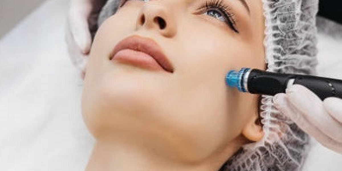 Unveiling the Marvels of Microneedling: A Pathway to Flawless Skin