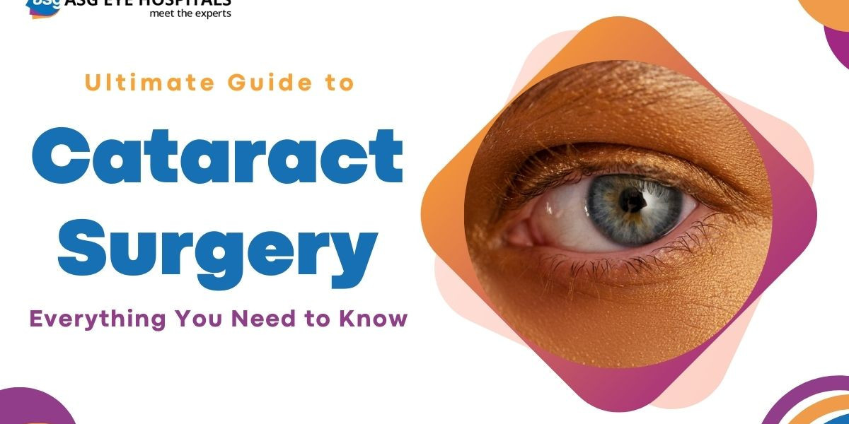 Ultimate Guide to Cataract Surgery: Everything You Need to Know