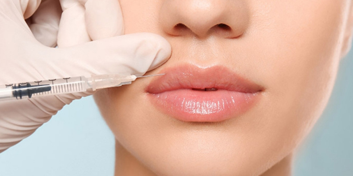 Affordable Dermal Fillers Cost in Langley | Bio-International Laser Clinic