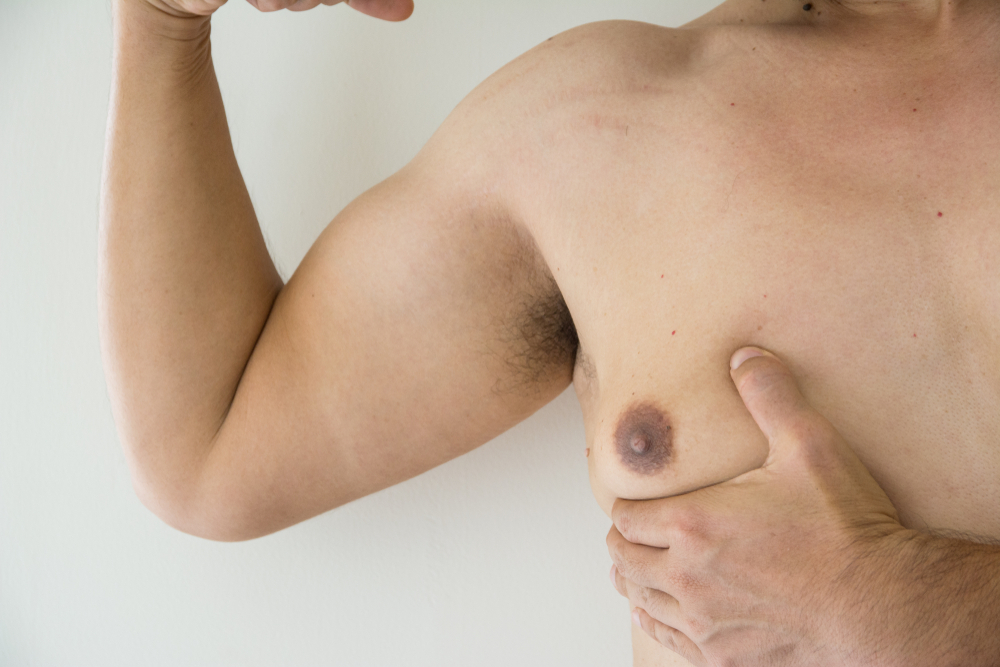Beyond Gynecomastia: Dubai's Holistic Approach | TechPlanet