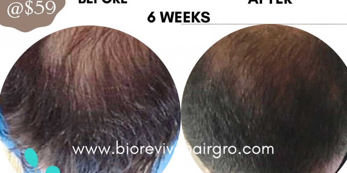 BioRevive HairGro's Top 10 Transformative Effects
