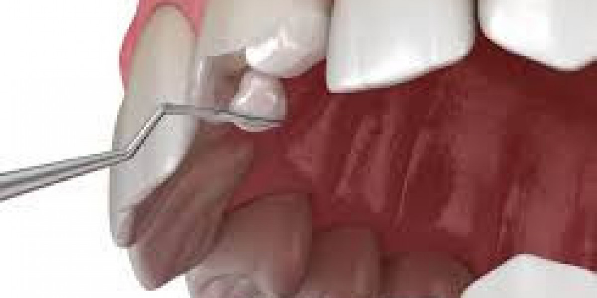 Restorative Dentistry Market By Product Application Manufacturer Sales and Segmentation - Forecast to 2024 – 2032