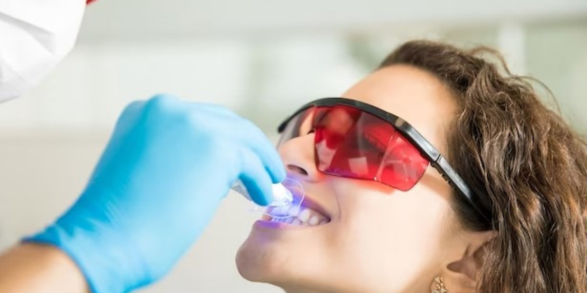 A Comprehensive Guide to Teeth Whitening Costs in Singapore