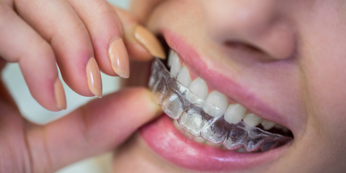 A Comprehensive Guide to Invisalign TX Treatment