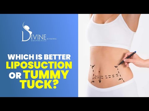 Abdominal Vaser Liposuction Surgery Cost In Delhi (India) : Cost & Procedure