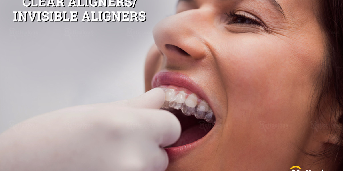 Asia-Pacific Clear Aligners Market to Hit $5.24 Billion by 2030