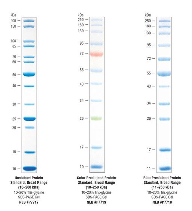 Protein Ladders: Types and Industry Uses | Articles | Unibiotech | Gan Jing World - Technology for Humanity | Video & Movie Streaming