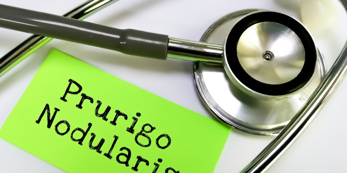 What is Prurigo Nodularis? Causes, Symptoms, and Risk Factors