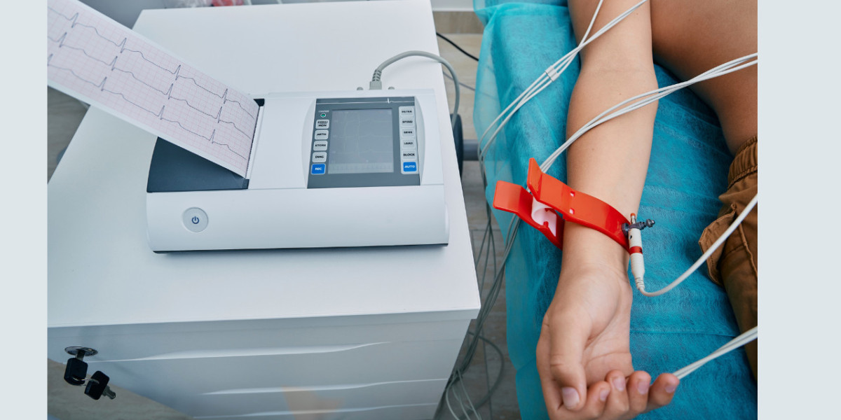 Find the Best ECG Scan Near Me – A Complete Guide to Heart Health