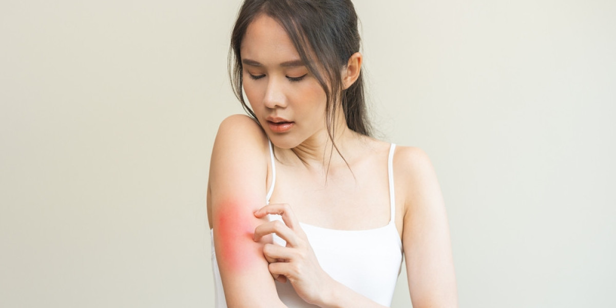 Kidney Disease and Skin Rashes: What You Need to Know