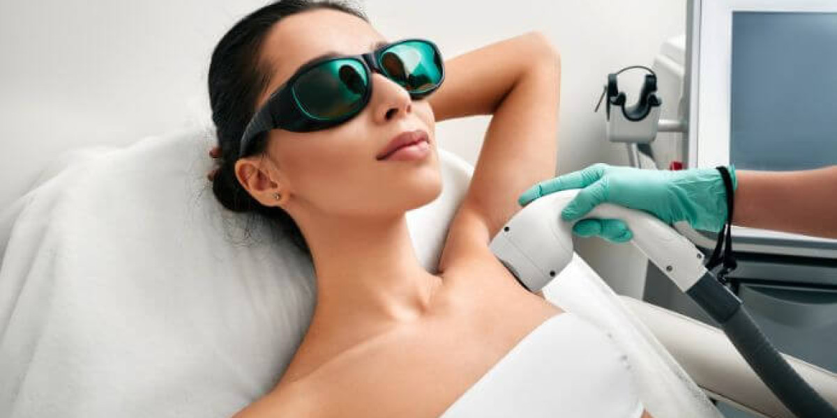 How Often Should You Get Laser Hair Removal for Best Results?