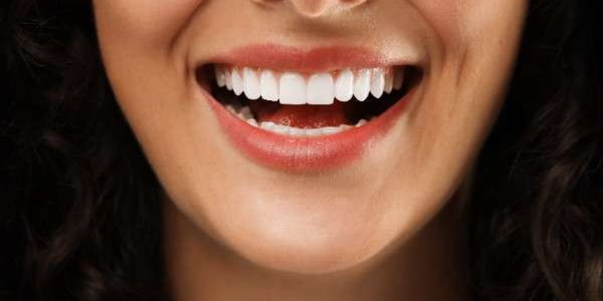Maintaining Your Restored Smile for Life in Wigan