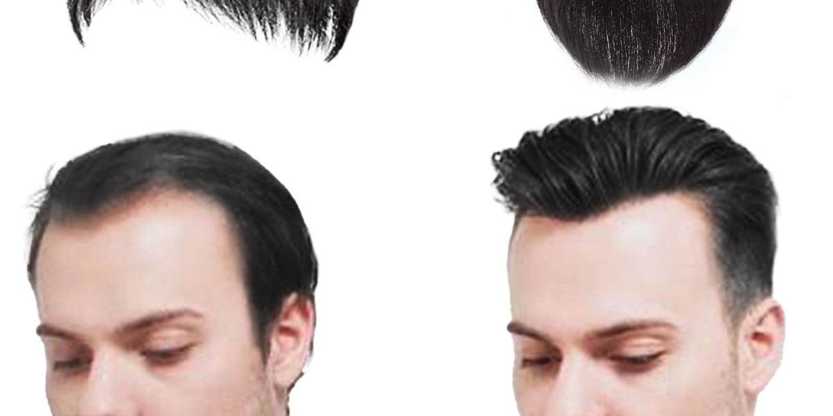 How To Buy Best Hair systems for men