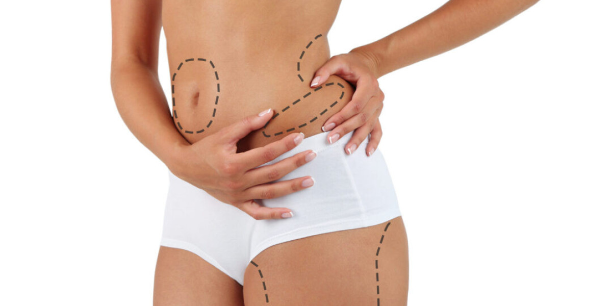 Minimally Invasive Liposuction Techniques in Islamabad