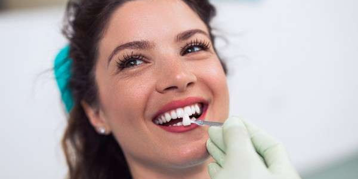 Erase Years of Stains with Targeted Whitening Solutions