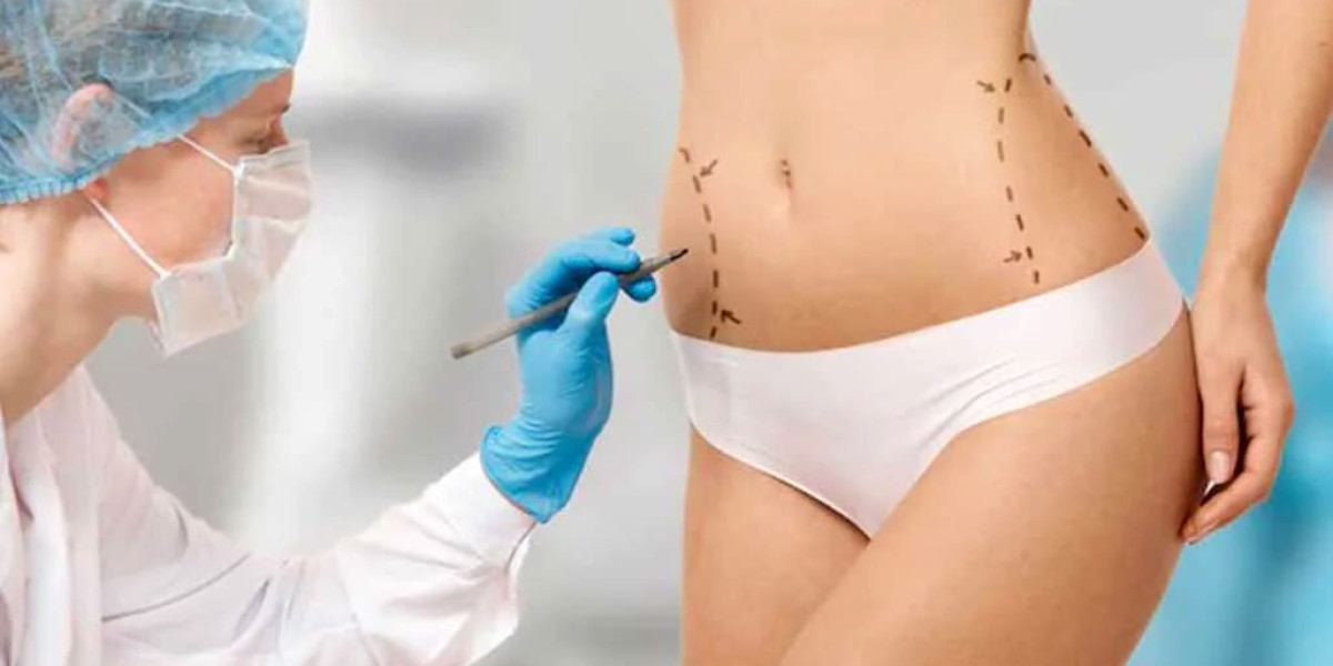 Latest Technology Used for Liposuction in Islamabad
