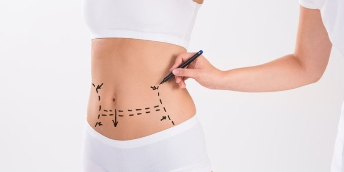 Is a Mommy Makeover with Tummy Tuck in Islamabad Worth It?