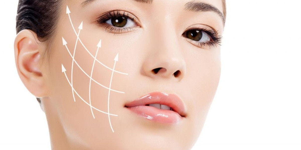 How Many Days Off Do You Need After Thread Lift in Islamabad?