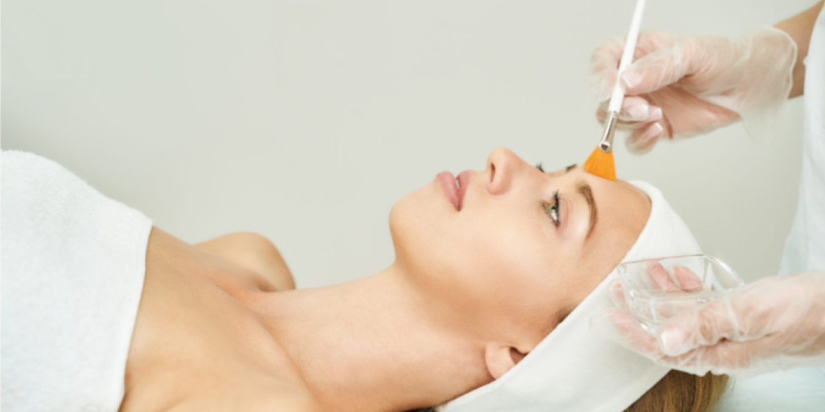 Real Reviews of Chemical Peels in Islamabad