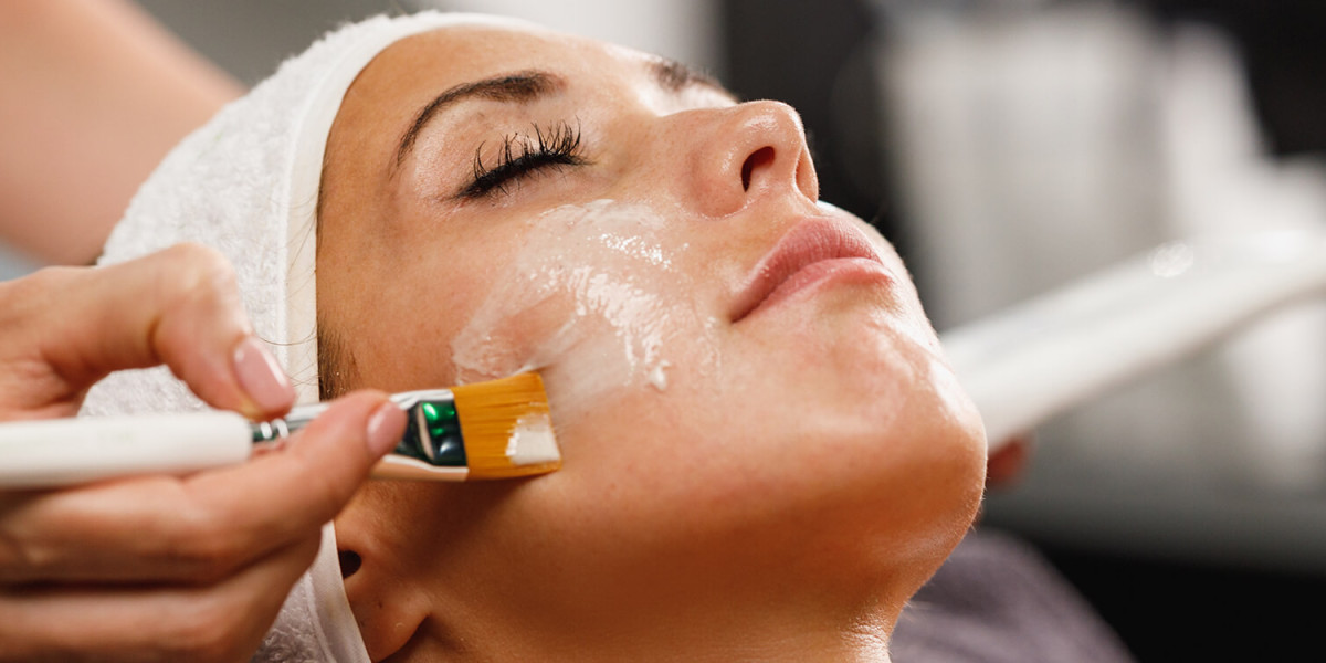 How Much Does a Chemical Peel Cost in Islamabad?