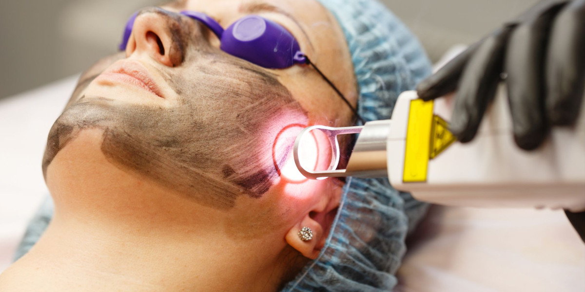 Beyond the Buzz: Real Results from PICO Laser Treatment in Islamabad