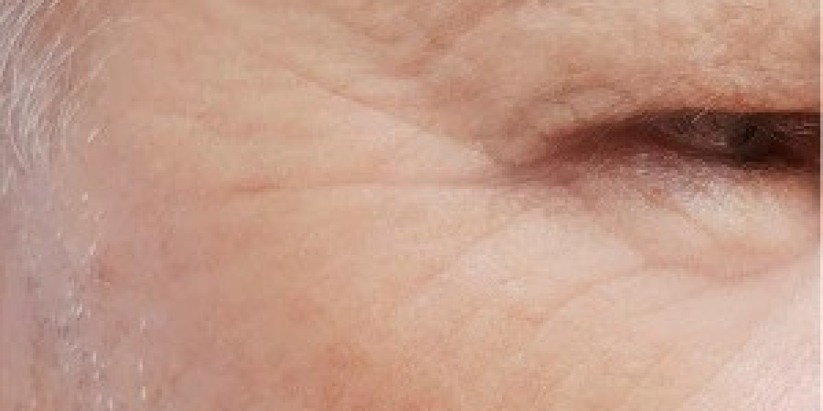 Top 5 Benefits of Botox for a Youthful Appearance