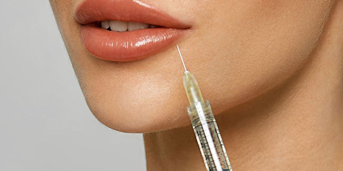 Lip Fillers for Brides-to-Be in Islamabad