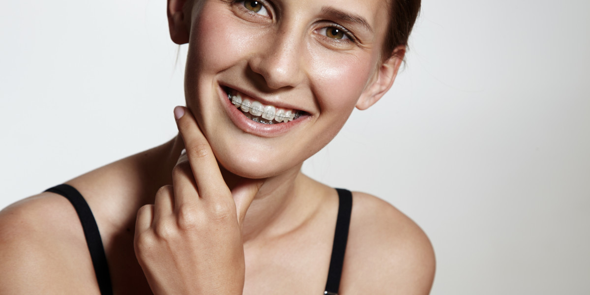 A Complete Guide to Braces: Types, Benefits, and Costs